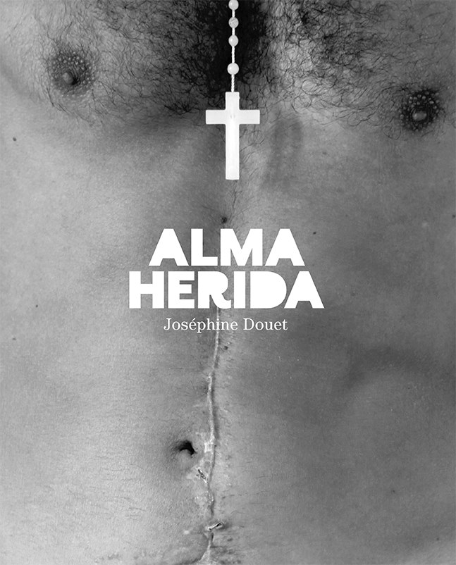 fb_alma